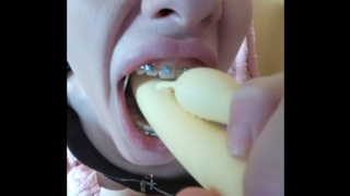 My braces want your spunk