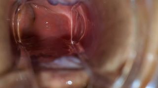 BIG BEAUTIFUL WOMAN Extreme Anal and Anus Speculum Gape